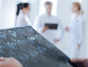 O que faz o fisioterapeuta em oncologia?