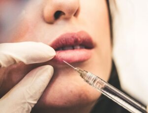Profissional de Biomedicina estética aplicando preenchimento nos lábios de uma mulher